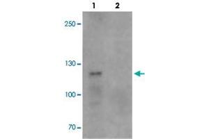 Western blot analysis of TCIRG1 in EL4 cell lysate with TCIRG1 polyclonal antibody  at 0. (TCIRG1 anticorps  (N-Term))