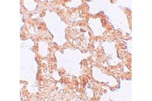 Immunohistochemical staining of rat lung cells with AXIN2 polyclonal antibody  at 5 ug/mL. (AXIN2 anticorps  (C-Term))
