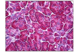 Human Pancreas: Formalin-Fixed, Parraffin-Embedded (FFPE) (Ferredoxin Reductase anticorps)