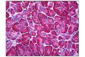 Human Pancreas: Formalin-Fixed, Parraffin-Embedded (FFPE) (Ferredoxin Reductase anticorps)