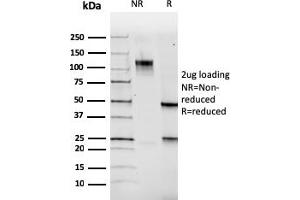 SDS-PAGE Analysis Purified PAX5 Mouse Monoclonal Antibody (PAX5/3735).