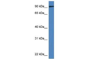 WB Suggested Anti-Dlg3 Antibody   Titration: 1. (DLG3 anticorps  (N-Term))