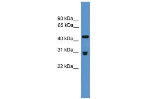 WB Suggested Anti-Pdyn Antibody Titration: 0. (PDYN anticorps  (Middle Region))