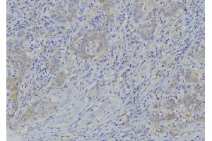 ABIN6273381 at 1/100 staining Human gastric tissue by IHC-P. (PDP2 anticorps  (N-Term))