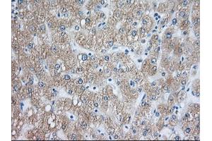 Immunohistochemical staining of paraffin-embedded Human pancreas tissue using anti-RAB17 mouse monoclonal antibody. (RAB17 anticorps)