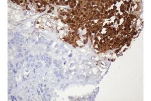 Image no. 2 for anti-Parvin, beta (PARVB) antibody (ABIN1496912)