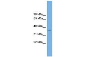 Image no. 1 for anti-DnaJ (Hsp40) Homolog, Subfamily C, Member 17 (DNAJC17) (AA 151-200) antibody (ABIN6744622) (DNAJC17 anticorps  (AA 151-200))