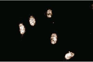 Immunofluorescence staining of human endothelial cells. (Cullin 3 anticorps  (AA 565-684))