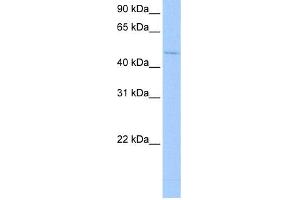 WB Suggested Anti-RBM45 Antibody  Titration: 0. (RBM45 anticorps  (Middle Region))