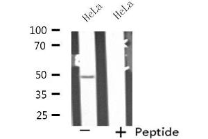 Western blot analysis of extracts from HeLa cells, using PPP2R2B antibody. (PPP2R2B anticorps  (Internal Region))