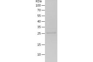 Western Blotting (WB) image for Endothelin 1 (EDN1) (AA 53-90) protein (His-IF2DI Tag) (ABIN7122781)