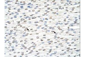 Image no. 1 for anti-DIS3-Like Exonuclease 2 (DIS3L2) (AA 121-170) antibody (ABIN202821) (DIS3L2 anticorps  (AA 121-170))