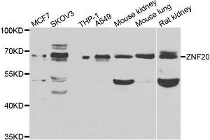 Western blot analysis of extracts of various cell lines, using ZNF20 antibody. (ZNF20 anticorps)
