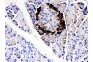 VIP was detected in paraffin-embedded sections of rat pancreas tissues using rabbit anti- VIP Antigen Affinity purified polyclonal antibody (Catalog # ) at 1 µg/mL.