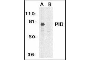 Western blot analysis of PID expression in HeLa whole cell lysates in the absence (A) or presence (B) of blocking peptide with this product at 1 μg /ml. (MTA2 anticorps  (AA 652-668))