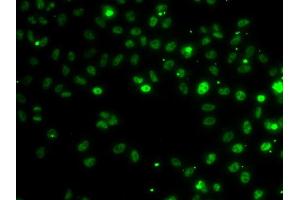 Immunofluorescence analysis of MCF-7 cells using RSRC1 antibody (ABIN6131423, ABIN6147283, ABIN6147284 and ABIN6223040). (RSRC1 anticorps  (AA 117-276))