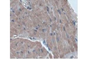 IHC-P analysis of Rat Heart Tissue, with DAB staining. (ORM1 anticorps  (AA 20-186))