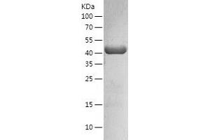 Western Blotting (WB) image for Mevalonate (Diphospho) Decarboxylase (MVD) (AA 1-400) protein (His-IF2DI Tag) (ABIN7123949)
