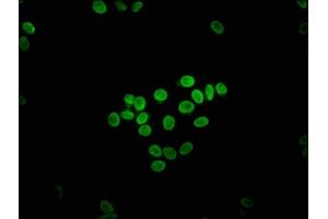 Immunofluorescence staining of HepG2 cells with ABIN7152078 at 1:133, counter-stained with DAPI. (ETV2 anticorps  (AA 74-201))