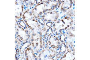 Immunohistochemistry of paraffin-embedded Rat kidney using CTGF Rabbit pAb (ABIN6127717, ABIN6139188, ABIN6139191 and ABIN6215222) at dilution of 1:100 (40x lens).