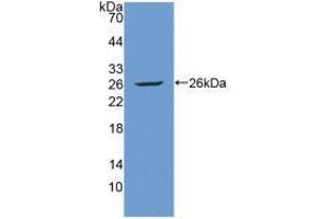 Western blot analysis of recombinant Human Tie1. (TIE1 anticorps  (AA 701-898))