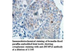 Image no. 1 for anti-Dual Specificity Phosphatase 16 (DUSP16) antibody (ABIN1576133)