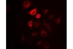 Immunofluorescent analysis of Omentin staining in Hela cells. (ITLN1/Omentin anticorps)