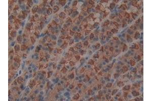 IHC-P analysis of Rat Stomach Tissue, with DAB staining. (MIA anticorps  (AA 36-127))