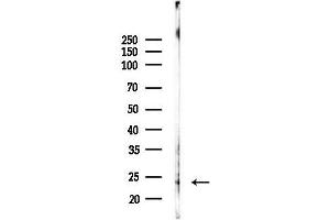 anti-Lysosomal Protein Transmembrane 4 beta (LAPTM4B) (Internal Region) antibody