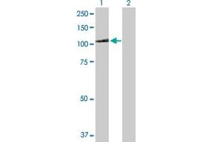Western Blot analysis of MTHFD1 expression in transfected 293T cell line by MTHFD1 MaxPab polyclonal antibody. (MTHFD1 anticorps  (AA 1-935))