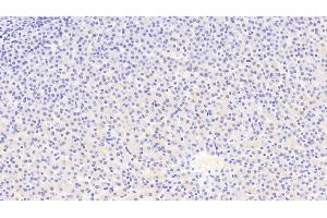 Detection of ATG16L1 in Human Liver Tissue using Polyclonal Antibody to Autophagy Related Protein 16 Like Protein 1 (ATG16L1) (ATG16L1 anticorps  (AA 342-607))