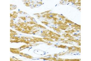Immunohistochemistry of paraffin-embedded Mouse heart using MS4A8B Polyclonal Antibody at dilution of 1:100 (40x lens).