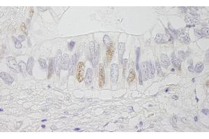 Immunohistochemistry (IHC) image for anti-Adenomatous Polyposis Coli (APC) (AA 1-50) antibody (ABIN7448412) (APC anticorps  (AA 1-50))