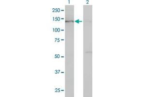 Western Blot analysis of BUB1 expression in transfected 293T cell line by BUB1 monoclonal antibody (M02), clone 2F9.