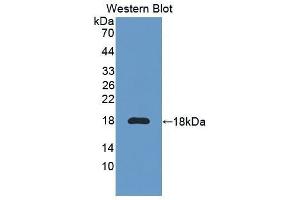Western Blotting (WB) image for anti-Interleukin 6 Receptor (IL6R) (AA 52-204) antibody (ABIN3206019) (IL-6 Receptor anticorps  (AA 52-204))