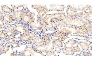 Detection of CASP6 in Bovine Kidney Tissue using Polyclonal Antibody to Caspase 6 (CASP6) (Caspase 6 anticorps  (AA 81-179))