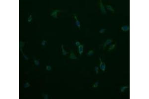 Image no. 5 for anti-Cytochrome C Oxidase Subunit VIc (COX6C) antibody (ABIN1497586)