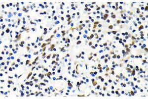 Immunohistochemistry of paraffin-embedded Human tonsil using MKL1 Polyclonal Antibody at dilution of 1:100 (40x lens). (MKL1 anticorps)