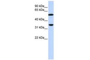 Image no. 1 for anti-Complement Component C4b (C4b) (AA 144-193) antibody (ABIN6743078)