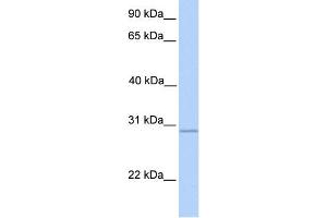 WB Suggested Anti-GALNT10 Antibody Titration:  0. (GALNT10 anticorps  (N-Term))
