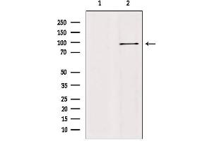 Western blot analysis of extracts from mouse brain, using AAK1 Antibody. (AAK1 anticorps  (Internal Region))