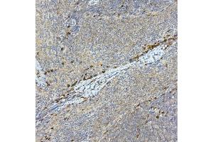 Immunohistochemistry of paraffin-embedded rat spleen using Tec Rabbit pAb (ABIN6128353, ABIN6148988, ABIN6148989 and ABIN6213654) at dilution of 1:100 (40x lens).