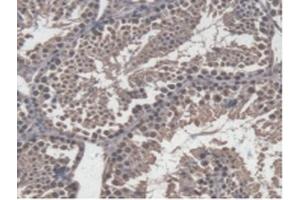 Detection of GBP4 in Mouse Testis Tissue using Polyclonal Antibody to Guanylate Binding Protein 4 (GBP4)