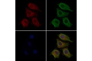 ABIN6257439 and ABIN6276207 staining Hela cells by IF/ICC.