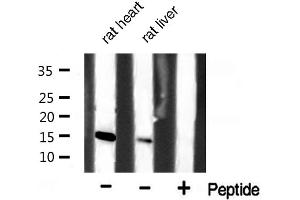 Western blot analysis of extracts of various celllines,using p15 INK Antibody. (CDKN2B anticorps  (Internal Region))