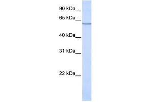 SLC1A1 antibody used at 1 ug/ml to detect target protein. (SLC1A1 anticorps  (N-Term))