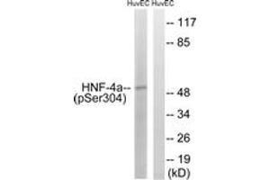 Western blot analysis of extracts from HuvEc cells treated with EGF 200ng/ml 30', using HNF4 alpha (Phospho-Ser313) Antibody.