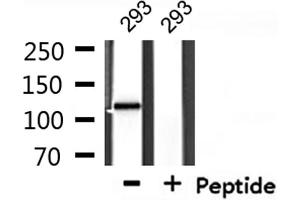 Western blot analysis of extracts from 293, using CARD6 Antibody.