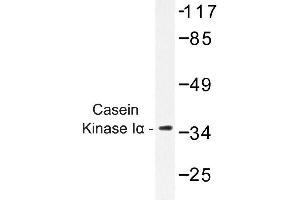 Image no. 1 for anti-Casein Kinase 1, alpha 1 (CSNK1A1) antibody (ABIN272195) (CSNK1A1 anticorps)