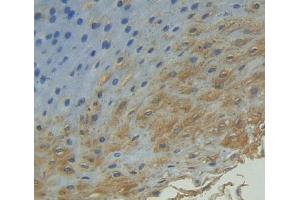 IHC-P analysis of Human Tissue, with DAB staining. (Cyclin B2 anticorps  (AA 58-398))